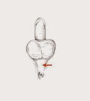 kraftvöðva og spennu þeirra til að auka kraftinn